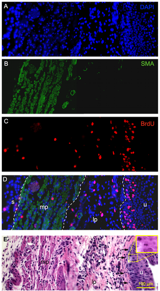 Illustration for article titled Could mammal bladders lead to amphibian-like organ regeneration in humans?